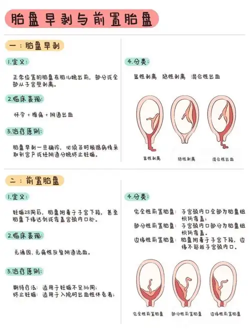 胎盘早剥与前置胎盘