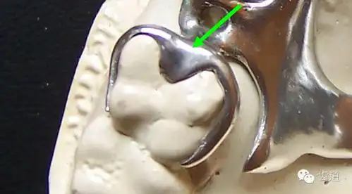 卡环的结构和各部分的作用