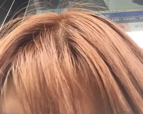 第一次染头发 ,染了这个亚麻色系,洗多了会变什么色,会很黄吗?