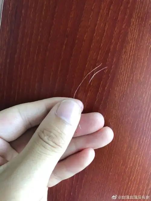 发现了一根正在生长的白发