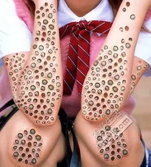 几张很恶心的图片呀密集恐惧症者慎入头皮发麻有木有