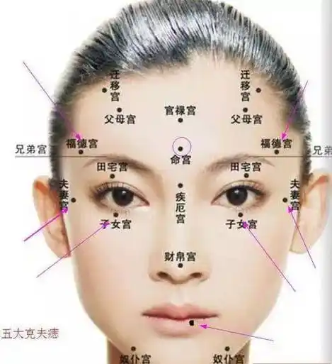 五处克夫痣,一定得祛 6015_女人