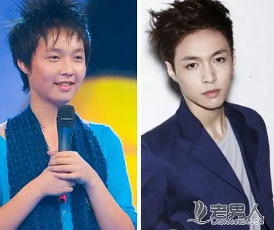 网曝张艺兴整容前后对比照关于这组疑似张艺兴整容前后对比的照片是真