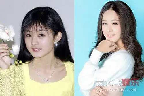 展开全部 赵丽颖在整容前和整容后的差别真的很大,特别是脸型上 ..
