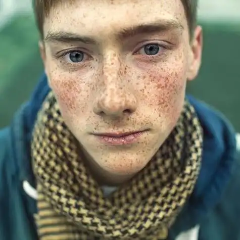 一脸麻子头像 头像图片大全 -【爱个性】