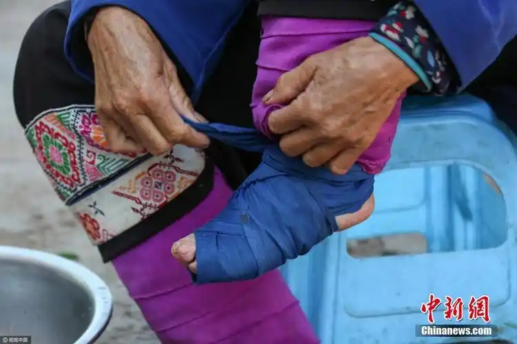 实拍最后的"裹足老人" 三四岁就开始缠脚