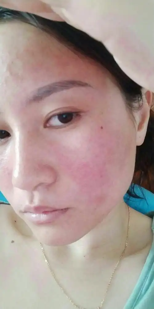 您可能是皮肤屏障受损了!