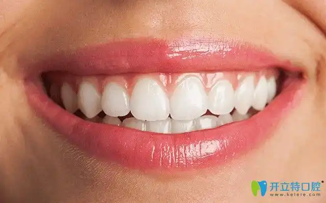 上下牙齿咬合不齐该怎么办需不要需做矫正呢