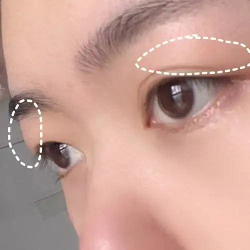 放几张步骤图你们参考一下,一定配合眼部产品一起哦肿眼泡|消肿|水肿