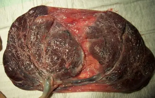 我吃过紫河车原来新鲜的胎盘是这种口感