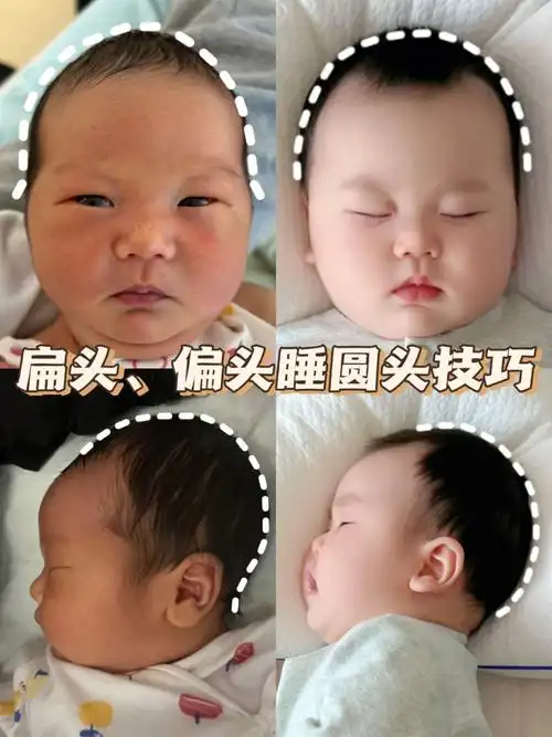 宝宝睡圆头技巧75宝宝睡头型偏头扁头逆袭圆