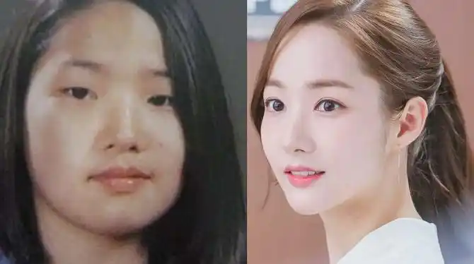 有一种变脸叫韩国整容双门洞王子贤成王祖贤她美成亚洲第一