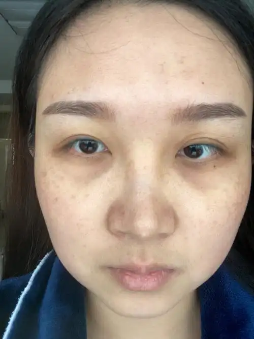 皮肤问题有多糟糕,终于开始治理了,治的好慢