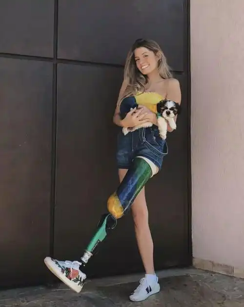 残缺了不敢露出自己不完美的一面不同于很多身体"不完美"的人贴在腿上