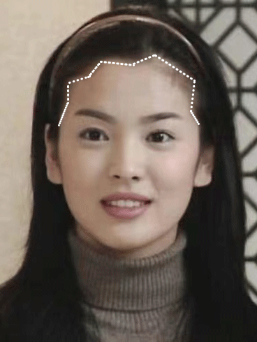 锯齿形发际线不流畅 :颅顶偏低 :发际线偏高 :现实中很少人能像刘亦菲