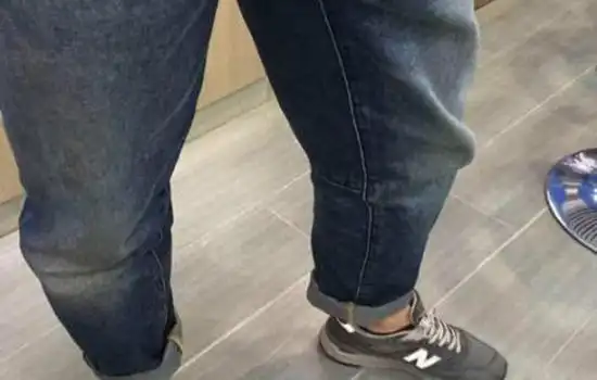 什么面料的裤子不起膝盖避免裤子膝盖鼓包窍门优质