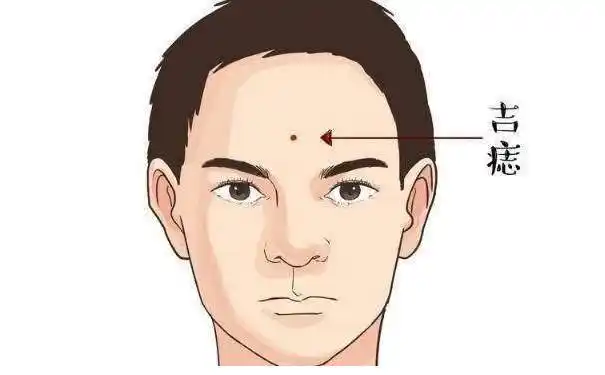 几种女人破财痣相 意外不断 赚再多的钱也存不住 -996手相网