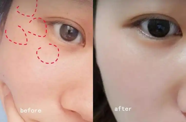 澳洲时尚杂志超模力荐锁水嫩肤效果大写的赞10000粒奶