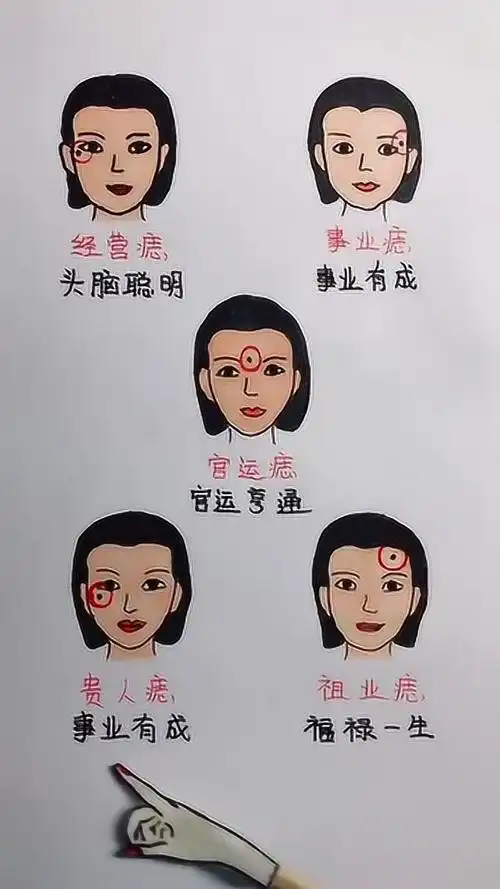 拥有这些痣命中注定的潜力股腰缠万贯衣食无忧