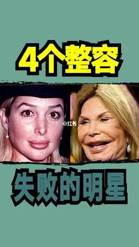 4个整容失败的明星