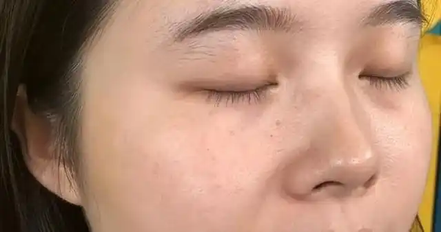 为什么皮肤会变暗沉?怎样做才能真正改善皮肤暗沉?看完就懂了