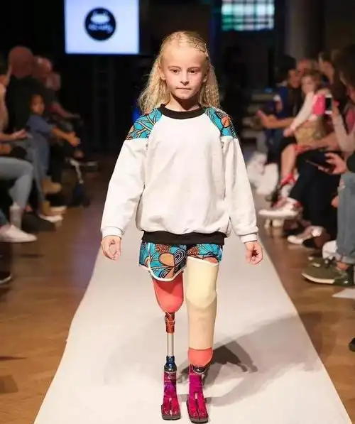 小女孩天生无腿9岁走t台美哭众人看到她的脸就忘了她的腿