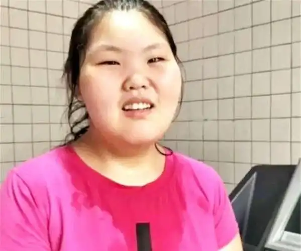 330斤胖女孩遭同学嘲笑,不惜休学减肥,最后惊艳所有人