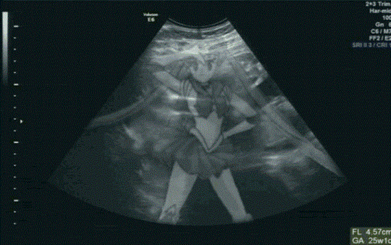 我怀孕了套路表情包:搞笑b超图