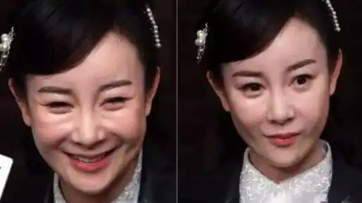 8位整容变毁容的女明星以前美貌动人现在僵硬成网红1