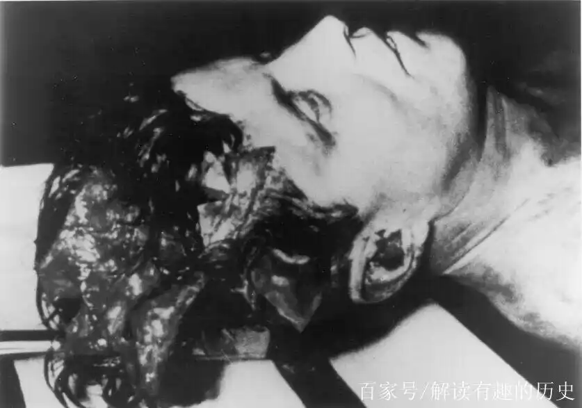 肯尼迪被"一枪爆头",遇刺前夕英国接到神秘电话,图5是嫌疑人