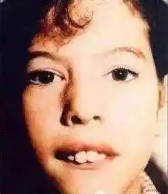 孩子出现天包地的情况需要及时矫正吗?