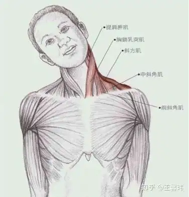 动作名字就是拉伸斜角肌,它的位置如图所示