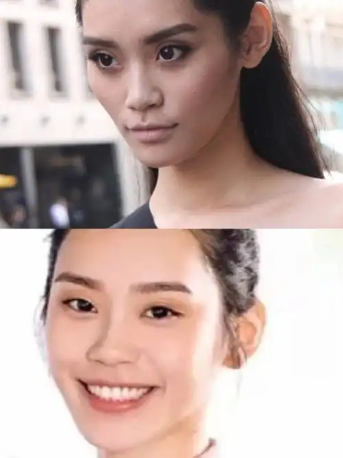 对比奚梦瑶填充前后奚梦瑶填充奚梦瑶对比照片奚梦瑶脸部填充对比奚