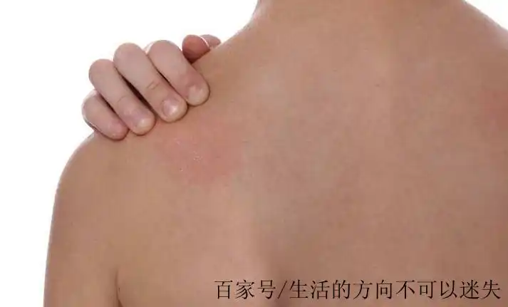 几种常见的皮肤刺激物,以及如何避免