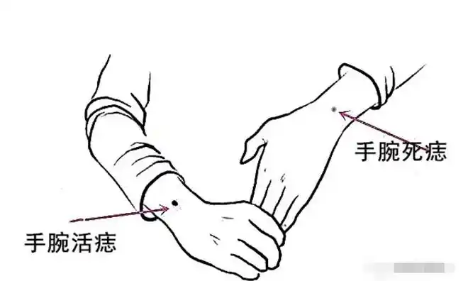 手腕长痣代表什么