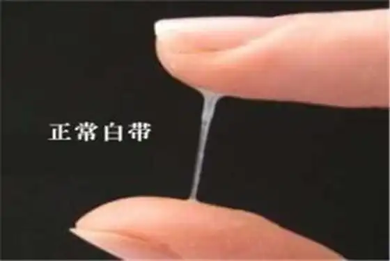 女性内裤发黄是正常现象吗?|白带|宫颈|宫颈炎_网易订阅