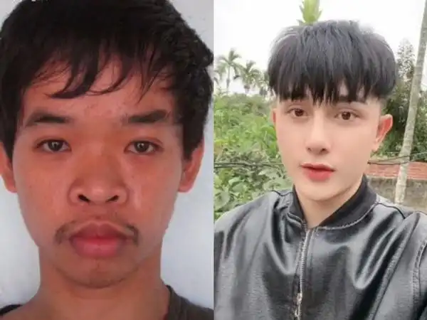 失业丑男花天价9次整容撞脸张东健晒整容前丑照人生意外改变