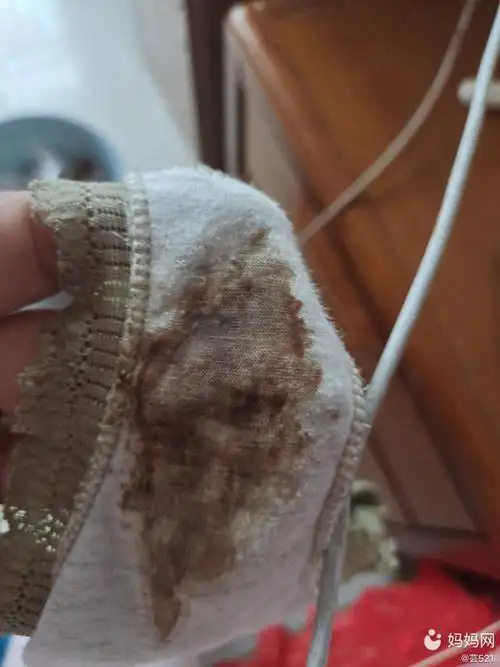 是不是见红了,就内裤有,等上完厕所都没了,为什么,_妈妈网孕育社区