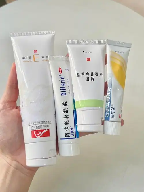 皮肤科医生推荐平价祛痘药膏痘痘肌福音