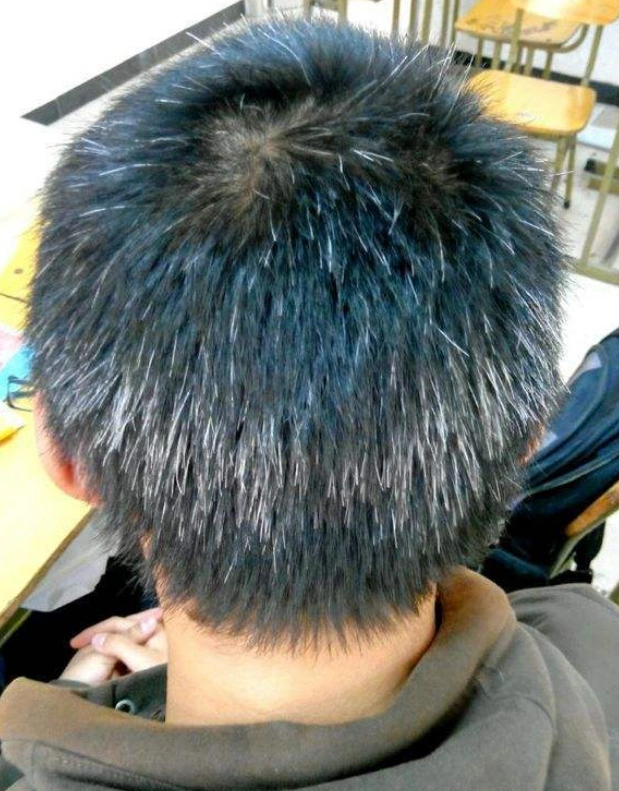 白发长在哪,病就从哪出?长在前额,两鬓,后脑勺,分别暗示什么