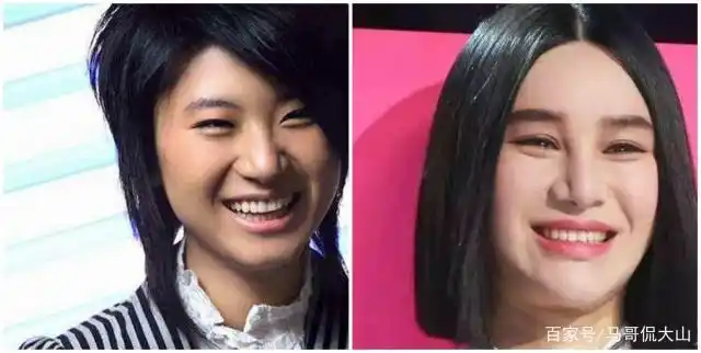 尚雯婕整容前后对比