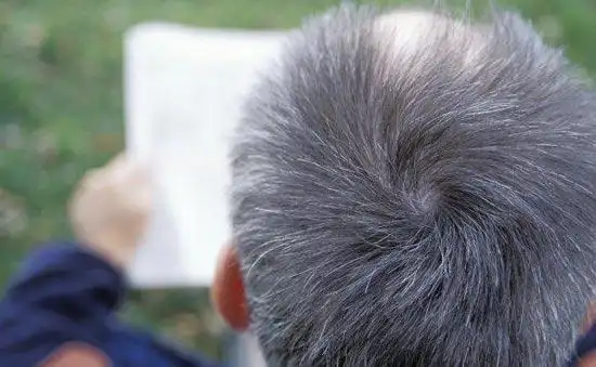 原标题:白发让人烦恼 科学家找到头发变白基因