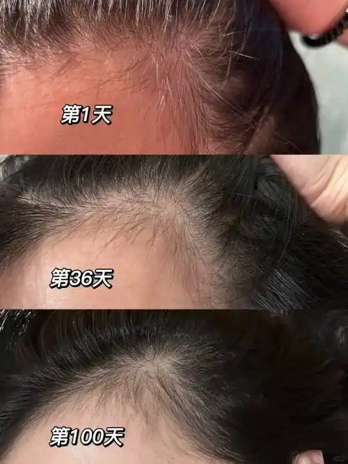 塌油头洗发水防脱生发哪个牌子好用榜一大家一致认可