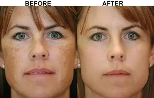 胞倍力nmn可以抗衰老吗?