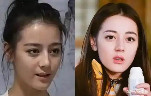 明星早期皮肤黑到现在的白,杨颖,刘涛,迪丽热巴对比非常明显