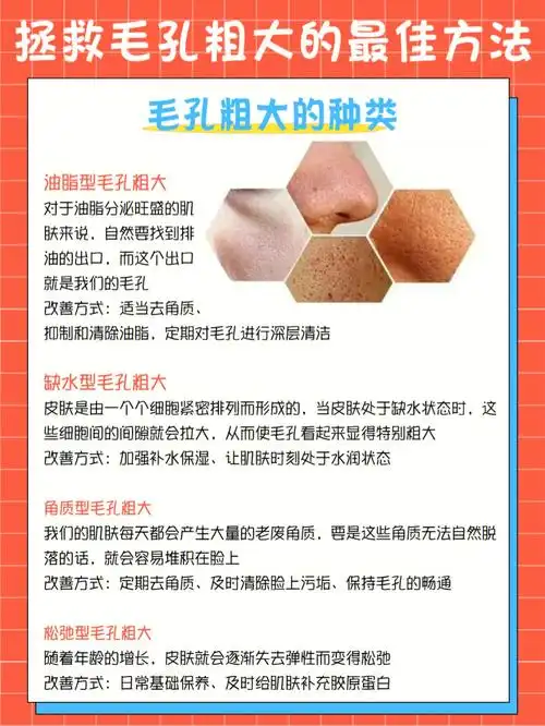五种拯救毛孔粗大的方法60