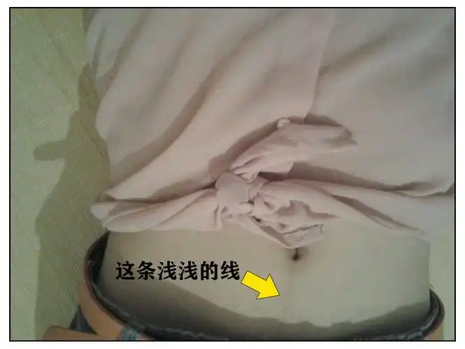 为什么肚脐眼下面会长毛还长成了一条直线