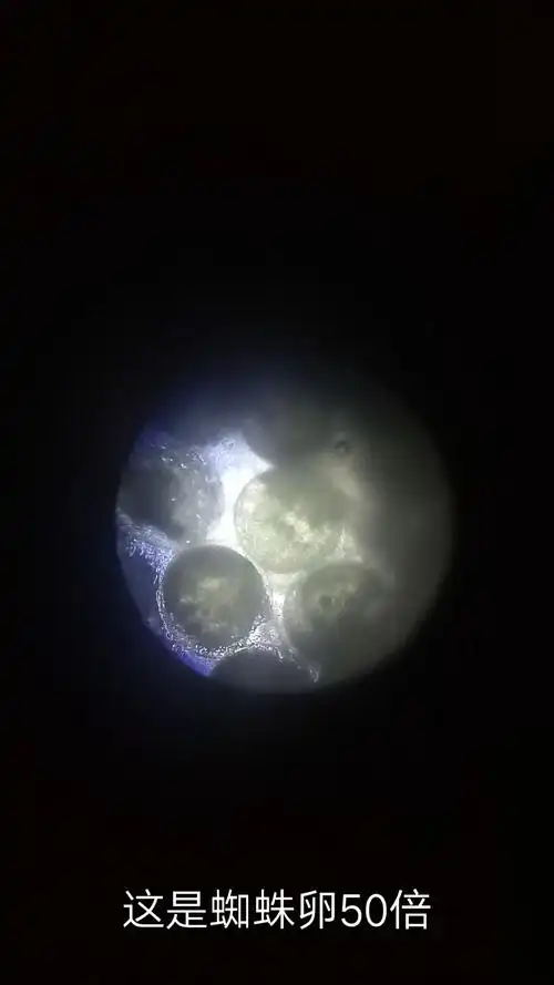 显微镜下的蜘蛛卵