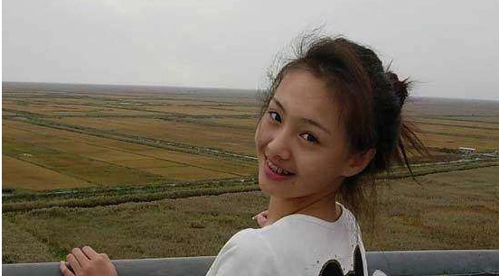 郑爽未化妆近照有点惊悚,疑似取出假体后鼻子扭曲