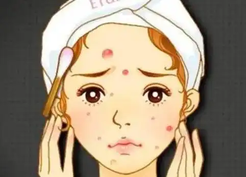 大连市皮肤病医院祛痘印的技术可靠吗祛痘医生信息去痘印案例